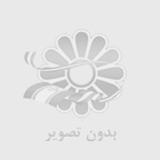 كامپوزيت و لمينت دندان